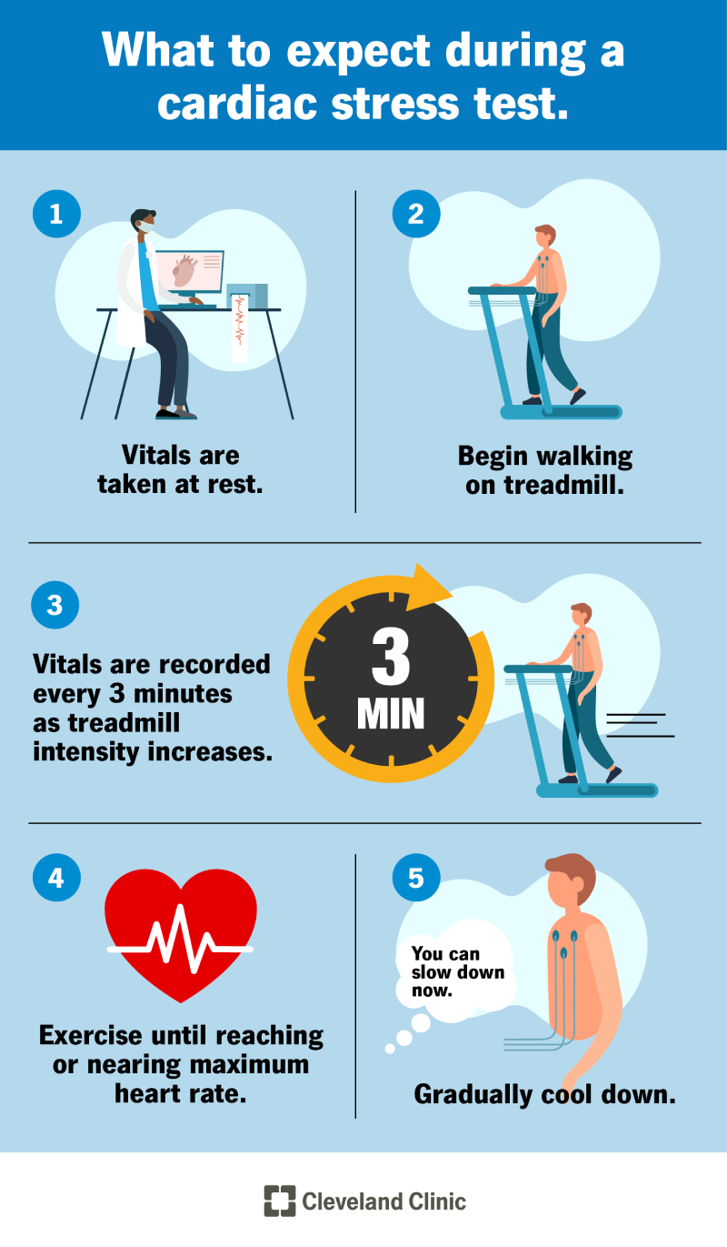 16984 exercise stress test 16984 exercise stress test