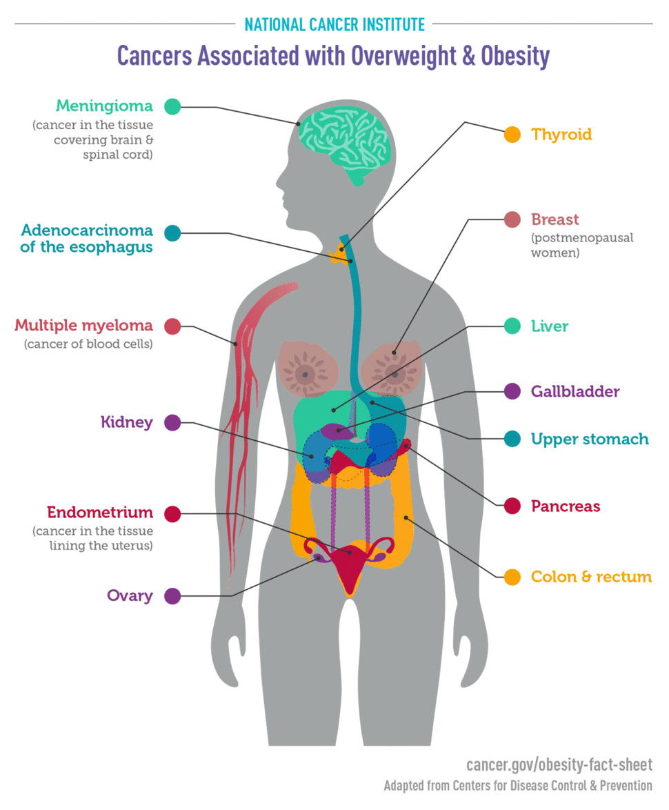 cancers associated with obesity infographic 970x1174 cancers associated with obesity infographic 970x1174