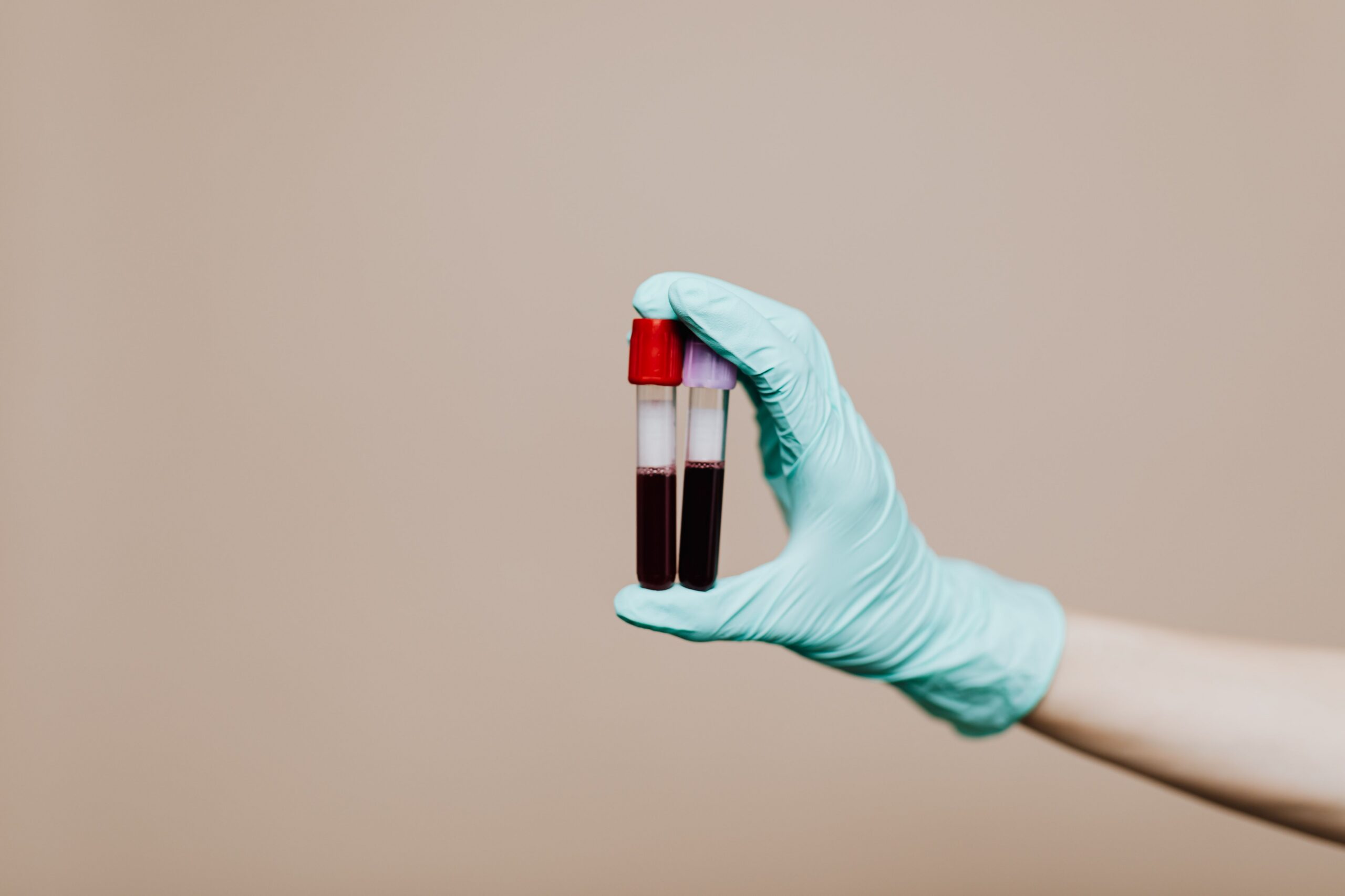 B12 deficiency: Why the fatigue you blame on aging might be fixable