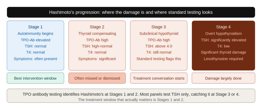 hashimotos progression