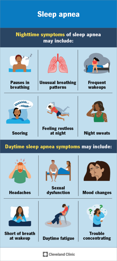 sleep apnea sleep apnea