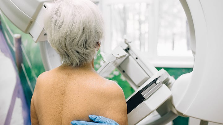 Less Overdiagnosis In Breast Cancer Screening Than Thought, Study Finds