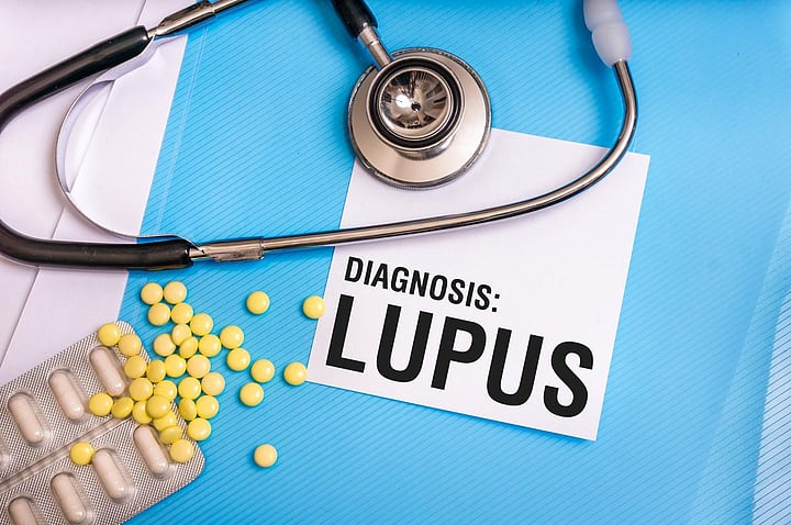 Lupus Patients Can Lower Their Heart Disease Risk By Sticking To One Common Treatment, Study Says