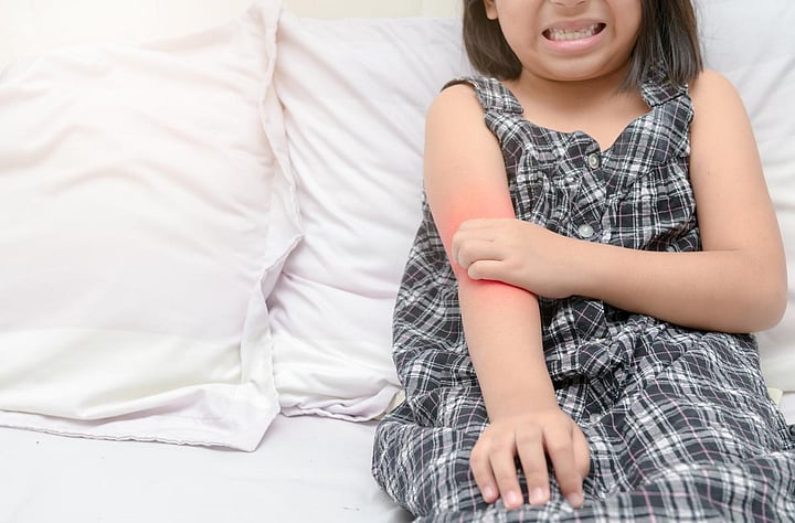 What's Living On Baby's Skin Might Predict Childhood Eczema Risk