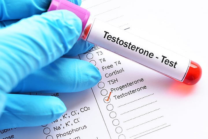High Testosterone Increases Risk Of Heart Rhythm Disorder, Review Finds