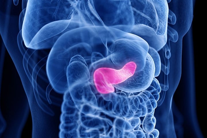 Blood Test Could Spot Deadly Pancreatic Cancer Sooner