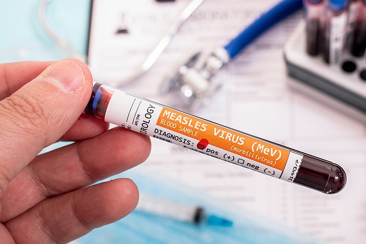 Third Measles Death In Pennsylvania Comes As State Case Count Tops 670