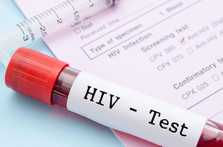 New Drug Combo Restores HIV Control